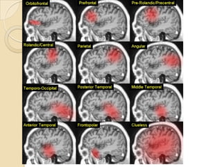Magnetic resonance angiography