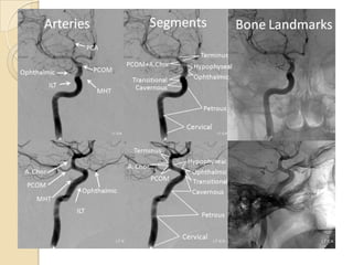 Magnetic resonance angiography
