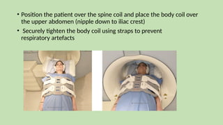 MAGNETIC_RESONANCE_CHOLANGIOPANCREATOGRAPHY_(MRCP)[1].pptx