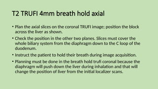 MAGNETIC_RESONANCE_CHOLANGIOPANCREATOGRAPHY_(MRCP)[1].pptx