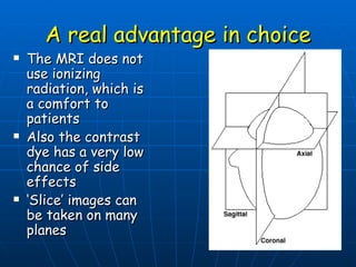 A real advantage in choice The MRI does not use ionizing radiation, which is a comfort to patients Also the contrast dye has a very low chance of side effects ‘ Slice’ images can be taken on many planes 