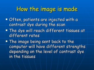 How the image is made Often, patients are injected with a contrast dye during the scan The dye will reach different tissues at different rates The image being sent back to the computer will have different strengths depending on the level of contrast dye in the tissues 