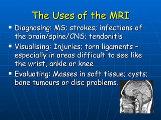 The Uses of the MRI Diagnosing: MS; strokes; infections of the brain/spine/CNS; tendonitis Visualising: Injuries; torn ligaments – especially in areas difficult to see like the wrist, ankle or knee Evaluating: Masses in soft tissue; cysts; bone tumours or disc problems. 