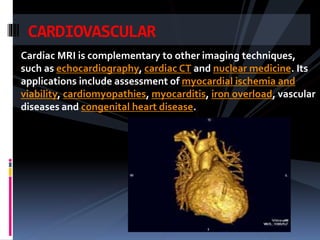 Is Math Included In Cardiovascular Radiology Magnetic resonance imaging | PPTX