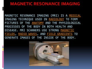 MAGNETIC RESONANCE IMAGING (MRI) IS A MEDICAL
IMAGING TECHNIQUE USED IN RADIOLOGY TO FORM
PICTURES OF THE ANATOMY AND THE PHYSIOLOGICAL
PROCESSES OF THE BODY IN BOTH HEALTH AND
DISEASE. MRI SCANNERS USE STRONG MAGNETIC
FIELDS, RADIO WAVES, AND FIELD GRADIENTS TO
GENERATE IMAGES OF THE INSIDE OF THE BODY.
MAGNETIC RESONANCE IMAGING
 
