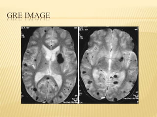 Magnetic resonance imaging | PPTX