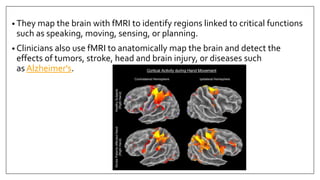 • They map the brain with fMRI to identify regions linked to critical functions
such as speaking, moving, sensing, or planning.
• Clinicians also use fMRI to anatomically map the brain and detect the
effects of tumors, stroke, head and brain injury, or diseases such
as Alzheimer's.
 