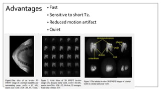 Advantages • Fast
• Sensitive to shortT2.
• Reduced motion artifact
• Quiet
 