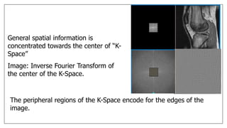 General spatial information is
concentrated towards the center of “K-
Space”
Image: Inverse Fourier Transform of
the center of the K-Space.
The peripheral regions of the K-Space encode for the edges of the
image.
 