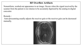 RF Overflow Artifacts
Nonuniform, washed-out appearance to an image. Occurs when the signal received by the
scanner from the patient is too intense to be accurately digitized by the analog-to-digital
converter.
Remedy :
Auto-prescanning usually adjusts the receiver gain or the receiver gain can be decreased
manually.
 