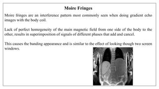 Moire Fringes
Moire fringes are an interference pattern most commonly seen when doing gradient echo
images with the body coil.
Lack of perfect homogeneity of the main magnetic field from one side of the body to the
other, results in superimposition of signals of different phases that add and cancel.
This causes the banding appearance and is similar to the effect of looking though two screen
windows.
 
