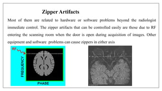 Zipper Artifacts
Most of them are related to hardware or software problems beyond the radiologist
immediate control. The zipper artifacts that can be controlled easily are those due to RF
entering the scanning room when the door is open during acquisition of images. Other
equipment and software problems can cause zippers in either axis
 