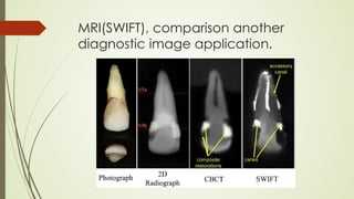 MRI(SWIFT), comparison another
diagnostic image application.
 