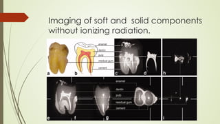 Imaging of soft and solid components
without ionizing radiation.
 