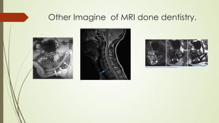 Other Imagine of MRI done dentistry.
 