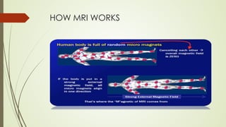 HOW MRI WORKS
 