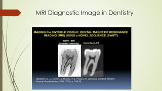 MRI Diagnostic Image in Dentistry
 