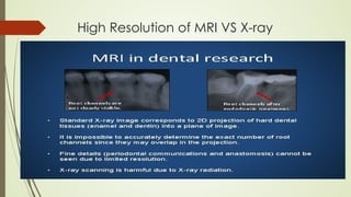 High Resolution of MRI VS X-ray
 