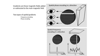 Comprehensive Overview of Magnetic Resonance Imaging Physics and ...