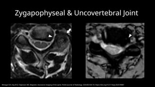 Magnetic Resonance Imaging Of Spine pptx magnetic-resonance-imaging-of-spine-pptx