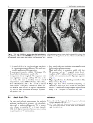 Magnetic resonance imaging of the knee | PDF