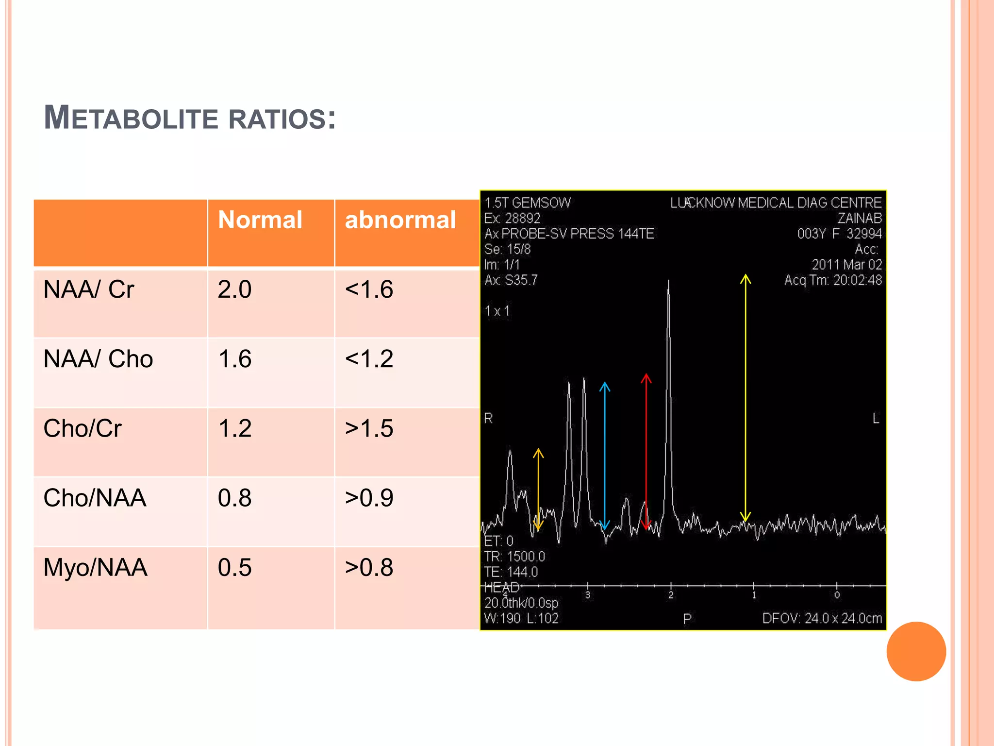 METABOLITE RATIOS:
Normal abnormal
NAA/ Cr 2.0 <1.6
NAA/ Cho 1.6 <1.2
Cho/Cr 1.2 >1.5
Cho/NAA 0.8 >0.9
Myo/NAA 0.5 >0.8
 