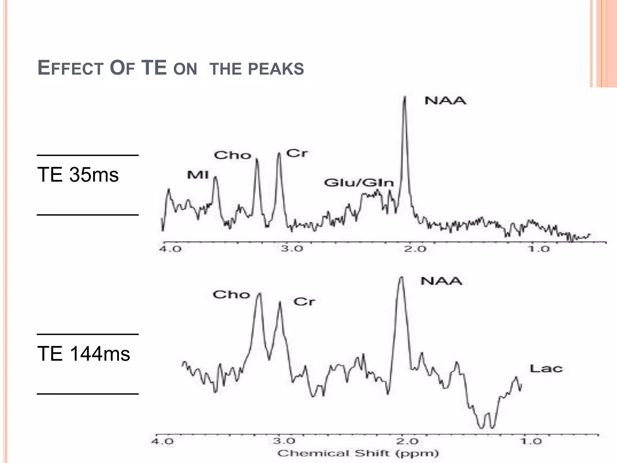 EFFECT OF TE ON THE PEAKS
__________
TE 35ms
___________
___________
TE 144ms
__________
 