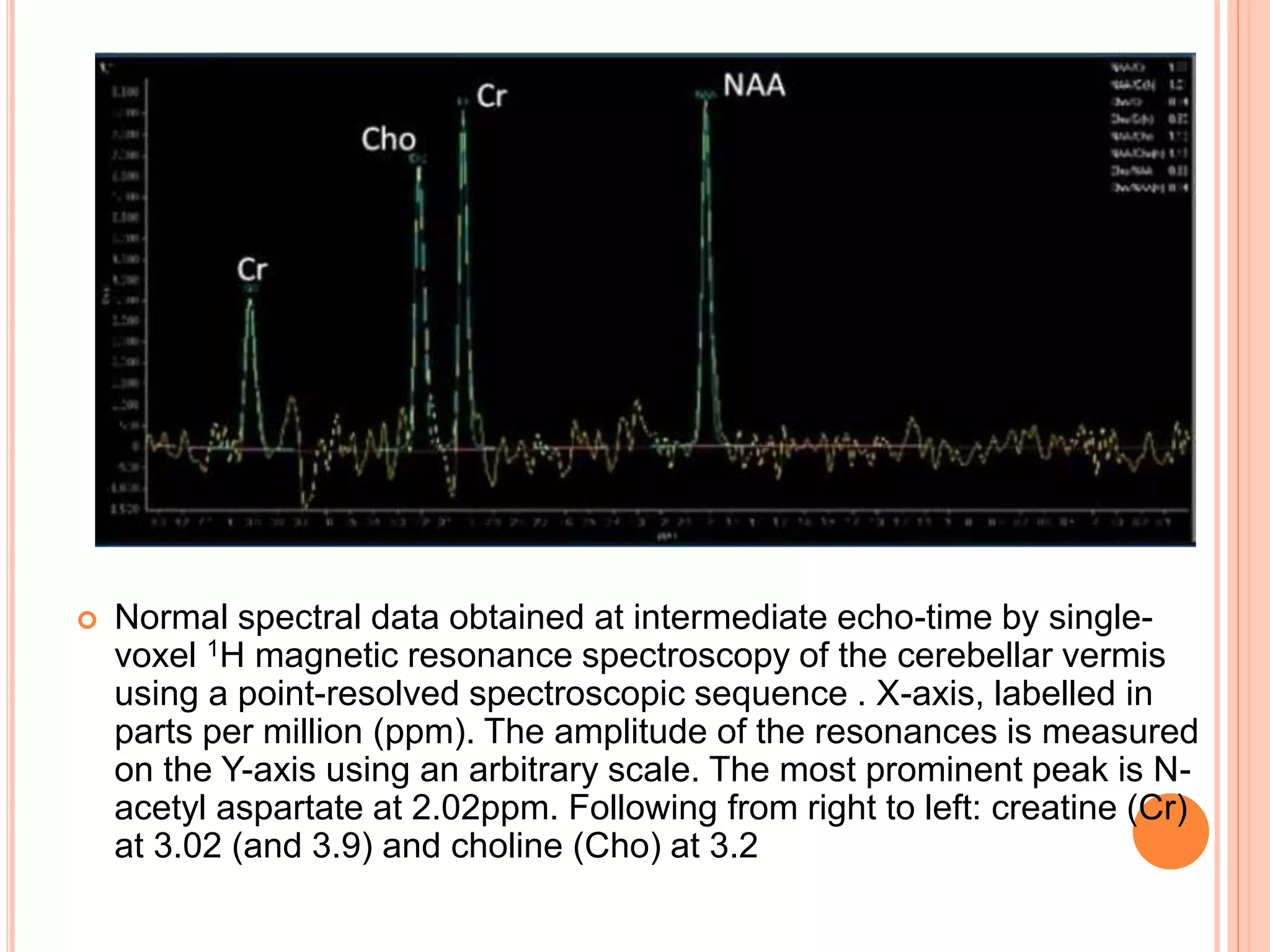  Normal spectral data obtained at intermediate echo-time by single-
voxel 1H magnetic resonance spectroscopy of the cerebellar vermis
using a point-resolved spectroscopic sequence . X-axis, labelled in
parts per million (ppm). The amplitude of the resonances is measured
on the Y-axis using an arbitrary scale. The most prominent peak is N-
acetyl aspartate at 2.02ppm. Following from right to left: creatine (Cr)
at 3.02 (and 3.9) and choline (Cho) at 3.2
 