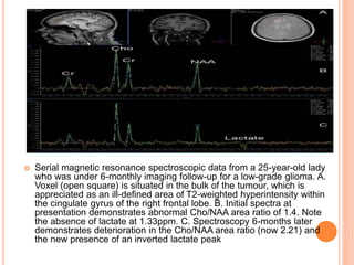 Magnetic resonance spectroscopy | PPTX