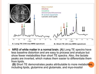 Magnetic resonance spectroscopy | PPTX