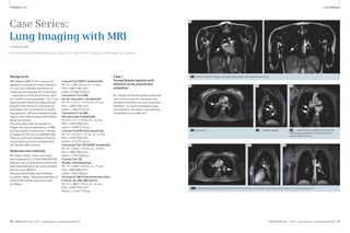 Clinical Lung Lung Clinical 
Case Series: 
Lung Imaging with MRI 
J. Biederer, MD 
University Hospital Schleswig-Holstein, Campus Kiel, Department of Diagnostic Radiology, Kiel, Germany 
Background 
MR imaging (MRI) of the lung can be 
applied in a variety of clinical scenarios. 
It is not only a feasible alternative to 
computed tomography (CT) of the lung 
– especially to avoid unnecessary radia-tion 
burden in young patients – but it can 
easily provide additional diagnostically 
relevant information on physiological 
parameters such as perfusion or respira-tory 
dynamics. Diffusion-weighted imag-ing 
can even add biological information 
about cell density. 
This case series aims to provide an 
insight into typical applications of MRI 
and to visualize characteristic findings. 
On page 6 of this issue of MAGNETOM 
Flash you will find a detailed review on 
lung imaging protocols available with 
the Siemens MR scanners. 
Materials and methods 
All images shown in this case series 
were acquired at 1.5 Tesla (MAGNETOM 
Avanto) with a combination of the body 
and integrated spine coil using software 
version syngo MR B17. 
Sequence parameters were adapted 
to patient needs. Selected parameters of 
some of the shown sequences were 
as follows: 
Coronal T2w HASTE (breathhold) 
TR / TE = 228 / 20 ms, SL = 8 mm, 
FOV = (500*500) mm2, 
matrix = (192p*320) px2 
Transversal T1w VIBE 
(no fat-saturation ; breathhold) 
TR / TE = 3.23 / 1.15 ms, SL = 4 mm, 
FOV = (384*450) mm2, 
matrix = (384*512i) px2 
Transversal T1w VIBE 
(fat-saturated; breathhold) 
TR / TE = 3.3 / 1.18 ms, SL = 4 mm, 
FOV = (350*400) mm2, 
matrix = (448*512i) px2 
Coronal TrueFISP (free-breathing) 
TR / TE = 412.8 / 1.16 ms, SL = 4 mm, 
FOV = (450*450) mm2, 
matrix = (512*512i) px2 
Transversal T2w TSE (SPAIR, breathhold) 
TR / TE = 2040 / 116 ms, SL = 6 mm, 
FOV = (380*380) mm2, 
matrix = (256*256) px2 
Coronal T2w TSE 
(BLADE, free-breathing) 
TR / TE = 2040 / 123 ms, SL = 5 mm, 
FOV = (480*480) mm2, 
matrix = (320*320) px2 
Transversal DWI (free-breathing; three 
b-values 50, 400, 800 s/mm2) 
TR / TE = 5983 / 79 ms, SL = 8 mm, 
FOV = (248*379) mm2, 
matrix = (115p*192) px2 
Case 1 
Young female patient with 
bilateral acute pulmonary 
embolism 
An 18-year-old female patient presented 
with clinical suspicion (dyspnoea and 
elevated D-dimeres) of acute lung artery 
embolism. To avoid unnecessary radia-tion 
exposure, this patient was referred 
immediately to our MR unit. 
1A 
1A Coronal TrueFISP images; the emboli are already well delineated (arrows). 
1B Transversal, … 
1B 
1C 1D 
1C … oblique sagittal, 
1D … oblique coronal contrast-enhanced 3D 
VIBE images visualize the right thrombus in 
greater detail (arrows). 
1E 1F 1G 
* 
1E–G Corresponding reconstructions of the left side thrombus; an infarction pneumonia can be seen in this area (marked by *). 
16 MAGNETOM Flash 1/2011 · www.siemens.com/magnetom-world MAGNETOM Flash · 1/2011 · www.siemens.com/magnetom-world 17 
 