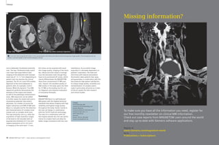 Clinical Cardiovascular Clinical 
T2w–TSE T1w–TSE fat-sat after contrast injection 
9 2 mm thin slices acquired off-center in this young patient with elbow pain demonstrate homogenous image quality. The homogenous fat sat 
shows a contrast-uptake in the humeral diaphysis (arrow). 
As successful image 
acquisition is ultimately dependent on 
patients’ corporation, the wide and 
short bore with internal and exterior 
illumination takes patients’ fear away 
and guarantees in combination with the 
fast protocols high patient satisfaction. 
Its unique image quality, versatility and 
standardization of complex exams 
make it particularly attractive as a state-of- 
the-art system for both research 
and clinical studies. 
Contact 
Henrik Michaely, MD 
Institute of Clinical Radiology and 
Nuclear Medicine 
University Medical Center Mannheim 
Theodor-Kutzer-Ufer 1–3 
68167 Mannheim 
Germany 
Phone: +49 621 383 2067 
henrik.michaely@umm.de 
9 
coil to dedicated 16-element extremity 
coils. The two 18-element body matrix 
coils mean that large-field-of-view 
imaging of the abdomen with isotropic 
voxel size of 1.3–1.7 mm (depending on 
patient size) has become the clinical 
standard. The 45 cm z-axis FOV enables 
depiction of the entire abdomen in 
patients with, for example, Crohn’s 
disease. While the dynamic T1w-VIBE 
sequences perfectly demonstrate the 
anatomy of the organs and vessels 
as well as the pathologic enhancement 
areas, DWI sequences can be added 
to further assess the bowel wall and to 
characterize potential inter-enteric 
abscesses. As a matter of course the 
higher robustness and SNR of DWI with 
Skyra is a valuable tool for the detection 
and characterization of complex renal 
masses such as complex renal cysts. 
The new extremity coils e.g. allow the 
acquisition of high-resolution images 
of the knee or the shoulder with an 
acquired slice thickness of 2 mm and 
inplane resolutions of 0.3–0.5 mm². 
In imaging of the wrist even 1.5 mm 
thin slices can be acquired with excel-lent 
image quality. Imaging of the shoul-der, 
elbow and wrist reveal a homoge-nous 
fat-saturation even though they 
have to be positioned off-center, which 
clearly differentiates the MAGNETOM 
Skyra from conventional 3T MR-scan-ners. 
Overall, this excellent quality of 
DWI studies in the body opens the field 
for 3T MRI as the leading tool for can-cer 
diagnosis and response evaluation 
of innovative therapies. 
Summary 
MAGNETOM Skyra is a well-balanced 
MR-system with the highest technical 
standards that allows imaging with high 
reliability and highest image quality 
throughout the body, thanks mainly to 
the new coil design in combination 
with the TimTX TrueForm technology. 
The new UI in combination with the 
Dot engines elevate also the user perfor-mance 
to a higher level and allow for 
better image consistence with less user-interference. 
Missing information? 
To make sure you have all the information you need, register for 
our free monthly newsletter on clinical MRI information. 
Check out case reports from MAGNETOM users around the world 
and stay up-to-date with Siemens software applications. 
Register at 
www.siemens.com/magnetom-world 
Go to 
Publications > Subscriptions 
30 MAGNETOM Flash 1/2011 · www.siemens.com/magnetom-world MAGNETOM Flash · 1/2011 · www.siemens.com/magnetom-world 31 
 