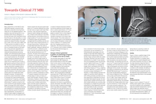 Technology Technology 
1 2 
1 The NYU 7 Tesla scanner. 2 Sagittal image of the ankle of a healthy adult subject. 
how a standard 3T clinical neuro imag-ing 
protocol can be translated to 7T, 
illustrating both advantages and chal-lenges 
of ultra-high-field imaging, and 
presenting the opportunity to obtain 
familiar image contrasts while also explor-ing 
higher resolution and new contrast 
mechanisms in a single 7T scan session. 
The musculoskeletal system has become 
another highly fruitful area of 7T appli-cation, 
and we begin our catalogue of 
images there, proceeding from foot to 
head. Body imaging at 7T (e.g. targeting 
the heart, abdomen, or pelvis) continues 
to present unique challenges at 7T. 
However, 7T body imaging has been the 
subject of intensive recent attention, 
with striking examples provided and cre-ative 
approaches undertaken by various 
ultra-high-field research groups. As men-tioned 
earlier, parallel transmission and 
other related methods are currently under 
investigation to mitigate the particularly 
substantial B1 inhomogeneities observed 
over large fields-of-view in the torso, 
and also to control SAR. Meanwhile 
robust imaging of selected body areas 
such as the breast may already be 
obtained at 7T with conventional single 
channel excitation. 
Note high-resolution depiction of cartilage and trabecular bone. 
(Fat-suppressed 3D FLASH, 0.23 x 0.23 x 1 mm3, TR/TE 26/5.1 ms, 
60 partitions, acquisition time 6:58 min, custom-designed 
transmit-receive extremity coil array with 8 receive elements.) 
At our institution, the past year or two 
has seen a surge of clinical interest in our 
7T scanner, as clinical colleagues in our 
Department of Radiology and elsewhere 
have partnered with our basic research-ers 
to probe anatomical details and patho-logic 
processes for which key informa-tion 
has proven to be elusive at lower 
field strength. The backlog and hours of 
use of our 7T system have both increased 
markedly, and it has become an increas-ingly 
commonplace occurrence to find a 
radiologist at the console. The images 
that follow, all obtained on the Siemens 
MAGNETOM whole-body 7T scanner at 
the Center for Biomedical Imaging at 
NYU School of Medicine (Fig. 1), illustrate 
some of the multifaceted clinical prom-ise 
of 7T MRI. These images, which we 
have sorted by body region and, when 
appropriate, disease process, are intended 
to indicate the image quality which may 
now be achieved at 7T with modern RF 
coil arrays and pulse sequences. The 
examples shown here represent only a 
subset of in vivo 7T scans at our center, 
and an even smaller subset of the work 
being done at a growing number of 
Siemens 7T sites around the world. 
Ankle 
Figure 2 shows a sagittal image of the 
ankle obtained at 0.23 x 0.23 mm2 
in-plane resolution in a healthy adult 
subject using a custom-designed trans-mit- 
receive extremity coil array [1]. Note 
the high-resolution depiction both of 
cartilage and of trabecular bone in this 
image. Although no particular pathology 
is evident in this example, the ability to 
resolve cartilage and bone structure at 
this level becomes a powerful asset for 
the detection and characterization of dis-ease 
processes like those in the examples 
to follow. 
Knee 
Osteoarthritis 
Figures 3 and 4 compare 7T scans of 
healthy adult subjects with correspond-ing 
scans of patients with radiographi-cally 
documented osteoarthritis. Each of 
these images was obtained using a 
28-element 7T knee coil array developed 
by Quality Electrodynamics (QED), LLC 
[2] and expected to be available com- 
Towards Clinical 7T MRI 
Graham C. Wiggins, D Phil; Daniel K. Sodickson, MD, PhD 
Center for Biomedical Imaging, Department of Radiology, New York University Langone 
Medical Center, New York, NY, USA 
Introduction 
Many researchers in the field of ultra-high- 
field magnetic resonance have 
become accustomed to bracing them-selves 
for an oft-repeated question. This 
question may arise during lulls in con-versation 
with clinical colleagues, or 
during interviews with interested visitors 
from the press or the lay public, or, more 
delicate still, during reviews of our appli-cations 
for research funding. The ques-tion 
is brief, and to the point: ‘When will 
7 Tesla scanners be ready for clinical 
use?’ Each of us has his or her own vari-ant 
on a standard answer to this ques-tion, 
citing particular populations or 
disease processes in which we have 
obtained extraordinarily promising 
images, and outlining the technical hur-dles 
which are gradually falling behind 
us as research advances. This twofold 
answer actually encapsulates two dis-tinct 
strains of 7T research, each of 
which has an important part to play in 
defining the eventual clinical role of 7T 
MR. The first involves identification of 
unique information available only at 
ultra-high field strength, enabled for 
example by extremely high spatial and 
spectral resolution or by contrast mech-anisms 
which are enhanced as field 
strength increases. The potential to 
access this unique information helped 
to motivate the original development 
of commercial 7T scanners, and fueled 
a great sense of enthusiasm as the first 
whole-body 7T systems arrived on the 
scene and the first jaw-dropping images 
began to emerge from those systems. 
This initial period of exuberant discovery 
was followed by an equally fascinating 
but also laborious period of extended 
basic development, during which 7T 
research teams began to grapple with 
the fact that not only the potential infor-mation 
content but also the routine oper-ations 
of 7T scanners differed from what 
we had come to expect with lower-field 
scanners. Coils and pulse sequences 
required careful redesign and optimiza-tion, 
artifacts only hinted at in low-field 
settings became critical determinants of 
image quality at 7T, and new constraints 
on sequence types and parameters 
changed both the workflow and the con-tent 
of day-to-day imaging protocols. In 
the past several years, a growing cadre 
of high-field researchers has risen to 
these challenges, seeking to identify the 
novel RF structures, calibration proce-dures, 
and spin manipulations that can 
eke the best performance out of 7T 
scanners. The goal of this second strain 
of research, occurring in parallel with 
the first, is to replicate some of the 
breadth and routine image quality of 
low-field scans, overcoming any and all 
practical obstacles along the way. Such 
nominally replicative research has actu-ally 
spurred a remarkable range of tech-nological 
and methodological innova-tion: 
witness the rise of parallel trans-mission 
techniques, reported in previous 
editions of this magazine, which have 
become a common component in many 
7T research programs but which have 
already begun to have an impact on 
lower field strengths. Perhaps of equal 
importance, however, is the fact that 
research aimed at achieving high image 
quality across multiple examination 
types and body regions addresses an 
important requirement for what might 
be considered an ideal clinical 7T imag-ing 
platform: the ability to provide 
unique clinically-relevant information for 
a variety of disease processes without 
sacrificing traditional clinical image con-tent 
in routine examinations. A 7T scan-ner 
with this ability need not be rele-gated 
to research tool or niche diagnos-tic 
device, but can take its place as a 
valuable component of the day-to-day 
clinical arsenal. This article reports on 
recent developments in the twofold pur-suit 
of unique information content and 
routine usability at 7T, drawing exam-ples 
from imaging experience at our 
institution. The clinical transformation 
of 7T scanning is by no means complete, 
but the picture that has begun to 
emerge is striking. 
Unique clinical potential: 
A gallery of pathology-targeted 
7T images from toe to head 
The principal advantages of ultra-high 
field strength for MR imaging are 
a) increased signal-to-noise-ratio (SNR), 
which can be used to increase spatial 
resolution, to shorten scan time, and/or 
to enable imaging of low-sensitivity 
nuclei other than hydrogen; and 
b) enhanced contrast mechanisms such 
as those based on susceptibility-related 
effects. The corresponding challenges 
associated with 7T MRI include increased 
inhomogeneity of the RF transmit and 
the B0 fields (which result in increased 
artifacts in various classes of pulse 
sequence) and increased RF energy 
deposition into tissue, as quantified by 
specific absorption rate (SAR), which can 
limit the range of sequence parameters 
which may safely be employed. 7T MRI 
of the brain has now become fairly rou-tine, 
with the availability of reliable high-performance 
head coils, and high qual-ity 
images in a variety of contrasts can 
be obtained. We will demonstrate later 
32 MAGNETOM Flash 1/2011 · www.siemens.com/magnetom-world MAGNETOM Flash · 1/2011 · www.siemens.com/magnetom-world 33 
 