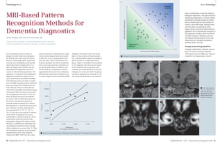 2 
Technology Neuro Neuro Technology 
MRI-Based Pattern 
Recognition Methods for 
Dementia Diagnostics 
Stefan Klöppel, MD1; Richard Frackowiak, MD2 
1Freiburg Brain Imaging, University Hospital Freiburg, Germany 
2Centre Hospitalier Universitaire Vaudois, Lausanne, Switzerland 
It is estimated that the number of 
people that will suffer from dementia 
by 2020 will be more than 40 million, 
with an increasingly higher proportion 
coming from developing countries [8]. 
Historically, brain imaging with CT or 
MRI has largely been used to rule out 
alternative and especially structural 
causes of the dementia syndrome. This 
approach is consistent with established 
diagnostic consensus criteria such as 
those published by the NINCDS-ADRDA 
[14]. Recently, there has been a realisa-tion 
that MRI may add positive predictive 
value to a diagnosis of Alzheimer’s dis-ease 
(AD) [9]. Several studies demon-strate 
that using MRI to evaluate atrophy 
of temporal lobe structures can contrib-ute 
to diagnostic accuracy [2, 22], but 
these findings have yet to be applied 
to routine clinical radiological practice, 
let alone in the general practice or 
internal medicine setting [22]. Recent 
developments in machine-learning anal-ysis 
methods and their application to 
neuroimaging [4–7, 10, 11, 13, 15, 
18–21] are very encouraging in relation 
to the levels of diagnostic accuracy 
achievable in individual patients. These 
multivariate methods promise fully-automated, 
standard PC-based clinical 
decisions, unaffected by individual neu-roradiological 
expertise which strongly 
affects diagnostic accuracy (Fig. 1). They 
are sufficiently sensitive to successfully 
separate those with mild cognitive 
impairment (MCI [16]) from the cogni-tively 
normal [3] or identify those cogni-tively 
normal subjects who will convert 
to MCI [4]. So far, computational anat-omy 
has been used to characterise dif-ferences 
between the brains of patients 
and normal age-matched volunteers at 
the group level. What is needed in the 
clinical setting is a diagnostic method 
applicable to each and every individual. 
Multivariate classification methods such 
as linear support vector machines (SVM) 
integrate information from the whole 
brain. In the context of machine learn-ing, 
individual MR images are treated as 
points located in a high dimensional 
space. Figure 2 illustrates this procedure 
in an imaginary two-dimensional space: 
In this example the two groups to be 
classified are represented by circles and 
triangles. It can be seen that the groups 
cannot be separated on the basis of val-ues 
along one dimension only and that 
only a combination of the two leads to 
adequate separation. The space used for 
classifying image data is of much higher 
dimension; the total number of dimen-sions 
is determined by the numbers of 
voxels in each MR image. Related meth-ods 
have been introduced to aid in 
breast cancer screening where they are 
applied to 2D X-rays and are now part of 
the diagnostic workup. With the advent 
of faster computer hardware, an accu-rate 
spatial transformation of the indi-vidual 
scan to a standard template is 
possible within minutes. 
Image processing pipeline 
To apply classification methods success-fully 
it is critical to extract relevant 
information from the MRI-scan. Figure 3 
magnifies the hippocampus area in 
0,00 25,00 50,00 75,00 
100,00 
90,00 
80,00 
70,00 
60,00 
Experience 
Percentage of dementia cases 
Accuracy 
1 Shows an increasing accuracy of radiologists more experienced in the diagnosis of dementia [10]. 
1 
3 The hippocampus 
region is displayed in 
two example cases 
before (top row) and 
after (bottom row) 
image processing. 
Volume anterior hippocampus 
Volume posterior hippocampus 
Alzheimer’s 
disease 
2 Concept of multivariate classification methods in a 2D example. 
3A 3B 
3C 3D 
healthy 
controls 
50 MAGNETOM Flash 1/2011 · www.siemens.com/magnetom-world MAGNETOM Flash · 1/2011 · www.siemens.com/magnetom-world 51 
 