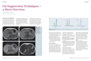 Technology Technology 
Fat Suppression Techniques – 
a Short Overview 
Wilhelm Horger; Berthold Kiefer 
Siemens Healthcare, Erlangen, Germany 
Introduction and background 
Fat-suppression is an integral part of 
nearly any routine MR application. Insuf-ficient 
elimination of the fat signal or 
even saturation of tissue of interest in 
an MR image can have severe conse-quences 
and therefore the knowledge 
about available fat-suppression tech-niques 
and their individual advantages 
and disadvantages are required. The 
purpose of this article is to provide a 
short technical overview of the main 
fat-suppression techniques available for 
clinical routine. 
All techniques for fat suppression are 
based on the fact that – due to the dif-ferent 
chemical environment – hydro-gen 
nuclei in water and in fat-tissue 
have different values for some MRI-rele-vant 
parameters, mainly the relaxation 
time and the resonance frequency 
fat 
3.4 ppm 
2 Spectral fat saturation. 
water 
2 
(chemical shift). These differences can 
be used to selectively suppress or reduce 
the signal of fat bound protons. Thus 
one can differentiate between two types 
of fat-suppression techniques: 
a) Relaxation-dependant (e.g. STIR) 
b) Chemical shift-dependant methods 
(e.g. Dixon technique (available for 
VIBE and TSE sequence techniques), 
spectral fat saturation, water excita-tion 
and SPAIR). 
Dixon technique 
The Dixon technique is based on the 
chemical shift i.e. the difference in reso-nance 
frequencies between fat and 
water-bound protons. With this tech-nique 
two images are acquired. In the 
first image the signal from fat-protons 
and from water-protons are ‘in phase’; in 
the second they are ‘opposed phase’. A 
separate fat and water-image can then 
RF excitation 
be calculated. The Dixon method is 
integrated into the VIBE sequence and 
TSE sequence (compare Fig. 1). 
Dixon delivers up to 4 contrasts in one 
measurement: in-phase, opposed-phase, 
water and fat images. 
Advantages of the Dixon technique: 
■ Insensitive to B0 and B1 inhomogeneities. 
■ 4 contrasts delivered in one mea-surement. 
Disadvantage of the Dixon technique: 
■ Increases minimal TR because in- and 
opposed phase data must be acquired. 
This can be compensated by using 
integrated Parallel Acquisition Tech-niques 
(iPAT). 
Spectral fat saturation 
This technique is based on the chemical 
shift (3.4 ppm) i.e. the difference in res-onance 
frequencies between fat- and 
water-bound protons. The application of 
a narrow band frequency selective radio-frequency 
(RF) pulse excites mainly fat-bound 
frequency 
+ Spoiling 
protons. This transversal magne-tization 
is destroyed afterwards by spoiler 
gradients, thus no fat magnetization is 
left for imaging (compare figure 2). 
For spectral fat saturation, a ‘Quick-Fat- 
Sat’ setting is available. If this feature is 
selected, not every slice excitation is 
preceded by a preparation pulse. This 
means: 
■ Shorter possible TR; 
■ Shorter breath-hold examinations (e.g. 
VIBE, recommended 40 lines/shot). 
Two FatSat modes (strong/weak) are 
also available. Basically, the user can 
select how much of the fat signal is con-tributing 
to the MR image. In the ‘strong’ 
mode a nearly full suppression is 
achieved, whereas in the ‘weak’ modus, 
anatomical information of fatty tissue is 
partially preserved. 
1A 1B 
1C 1D 
1 Dixon tech-nique 
(VIBE). 
Four contrasts 
generated in one 
breathhold: 
1A: in-phase 
1B: opposed-phase 
1C: water image 
1D: fat image 
56 MAGNETOM Flash 1/2011 · www.siemens.com/magnetom-world MAGNETOM Flash · 1/2011 · www.siemens.com/magnetom-world 57 
 
