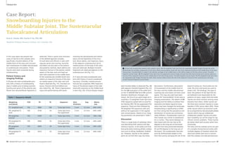 Clinical MSK MSK Clinical 
1A 1B 1C 
1 26-year-old snowboarder presents with subtalar injury. 1A: PD-weighted Turbo Spin Echo fat suppressed sagittal images through the ankle 
demonstrate the multiple components of this injury. Bone marrow edema shows the site of the impaction fracture of the middle facet of the talus 
(long arrow). Chondral defect is noted in the articular cartilage of the middle facet on the inferior aspect of the talus (short arrow). Chondral 
fragment (arrow head). 1B: PD-weighted Turbo Spin Echo fat suppressed coronal images through the ankle demonstrate bone marrow edema at 
the site of the impaction fracture of the middle facet of the talus (long arrow). Chondral fragment (arrow head). 1C: PD-weighted Turbo Spin Echo 
fat suppressed axial images through the ankle. Bone marrow edema shows the site of the impaction fracture at the sustentaculum tali (long 
arrow).Chondral fragment (arrow head). 
ated chondral defect is observed (Fig. 2B) 
with adjacent chondral fragment (Fig. 2C). 
For the MR evaluation of the ankle joint 
on the 3T MAGNETOM Verio MR scanner 
(Siemens Healthcare, Erlangen, Ger-many), 
the first of our axial image set is 
routinely a T2-weighted Turbo Spin Echo 
(TSE) sequence, paired with an axial Pro-ton 
Density (PD) TSE fat suppressed (FS) 
sequence. These are then followed by 
PD-weighted TSE sequences with and 
without fat suppression in the sagittal 
and coronal planes. Details of our imag-ing 
parameters are presented in Table 1. 
Discussion 
There is a large body of radiologic litera-ture 
describing both osseous and liga-mentous 
injuries, to the ankle and hind-foot 
particularly involving athletic endeav-ours 
such as skiing, basketball, football 
etc. However, injuries to the subtalar 
joints do not find their way into these 
discussions. Furthermore, discussions 
of involvement of the middle facet of 
the talus and the middle talocalcaneal 
sustentacular articulation are even more 
sparse. This may very well have been 
due to the “inaccessibility” of the area to 
imaging examination. The advent of MR 
imaging and the ability to achieve finer 
resolution and better signal-to-noise 
ratios may have changed the landscape. 
Snowboarding is significantly so differ-ent 
from skiing that the prevalence and 
distribution of injuries are commensu-rately 
different. Snowboarders stand on 
their boards very similar to skateboard-ers 
or surfers. They stand sideways on 
their board with the rear foot at 90 
degrees to the long axis of the board 
and the front foot positioned between 
45 and 90 degrees to the long axis of 
the board. The snowboarder executes 
turns by shifting body weight to the 
front foot and by swinging the tail of the 
board to swing out. Since poles are not 
used, the arms and hands are used to 
break a fall. The bindings, the type of 
boot, the patterns of the lead foot etc. 
are believed to be responsible for the 
patterns of injury. Upper limb and ankle 
injuries are more common among snow-boarders 
than skiers. Ankle injuries are 
the third most common injuries in snow-boarders 
(16%) versus skiers (6%). These 
ankle injuries which are torsional could 
be accompanied by talocalcaneal/subtalar 
injuries which may go undetected. 
Undetected subtalar injuries and atten-dant 
instability can set the stage for sig-nificant 
chronic problems. These injuries 
are better dealt with acutely rather than 
chronically. 
The talus and the subtalar joints are part 
of a complex biomechanical entity with 
multiple degrees of freedom where the 
talocrural (ankle) joint acts in concert 
with the subtalar and talocalcaneonavic- 
Case Report: 
Snowboarding Injuries to the 
Middle Subtalar Joint. The Sustentacular 
Talocalcaneal Articulation 
Anna K. Chacko, MD; Charles P. Ho, PhD, MD 
Steadman Philippon Research Institute, Vail, Colorado, USA 
In this case report we present two 
cases of injuries to the subtalar joint, 
specifically chondral defects of the 
middle facet of the talus and concomi-tant 
involvement of middle talocalcaneal 
or sustentacular articulation. These 
injuries were both sustained during 
snowboarding. 
Patient history and 
imaging fi ndings 
A 26-year-old male snowboarder pres-ents 
with a history of snowboarding 
injury 3 weeks prior to being scanned. 
Scarring and sprain of the anterior talo-fibular 
and calcaneofibular ligaments is 
observed. There is sprain and contusion 
of the deltoid ligament complex. 
A small talocrural effusion is seen with 
capsular sprain and scarring. Synovitis 
and debris are also seen in the anterior 
and posterior recesses. Bone edema and 
impaction fracture of the plantar medial 
aspect of the talar neck and head are 
seen with extension to the middle facet. 
At the sustentacular (middle facet) artic-ulation 
an impaction fracture of the plan-tar 
medial aspect of the talar neck and 
head is observed (Fig. 1A). Chondral con-tusion, 
fracture and focal defects are 
also noted (Fig. 1B). There is ligamentous 
injury and partial tearing with sprain 
involving the talocalcaneal and interos-seous 
cervical ligaments of the sinus 
tarsi. Bone edema, and impaction injury 
of the adjacent sustentaculum tali to 
medial portion of the body of the calca-neus 
are observed. Multiple chondral 
fragments are observed adjacent to the 
sustentaculum tali (Fig. 1C). 
A 27-year-old male snowboarder pres-ents 
with history of recent snowboard-ing 
injury. Clinically, a lateral process 
fracture was suspected. Mild impaction 
injury of the plantar aspect of the talar 
head with extension to the middle facet 
is seen (Fig. 2A). A focal sharply margin- 
Table 1: Sequence details 
Weighting FOV TR TE Sequence Slice Gap Matrix 
and planes thickness size 
T2- weighted axial 100 3860 108 Turbo Spin Echo 3 mm 0.3 mm 640 x 640 
PD- weighted FS 100 3730 43 Turbo Spin Echo 3 mm 0.3 mm 640 x 640 
axial Fat suppressed 
PD-weighted 100 4340 33 Turbo Spin Echo 3 mm 0.3 mm 768 x 768 
coronal 
PD-weighted FS 100 4660 43 Turbo Spin Echo 3 mm 0.3 mm 640 x 640 
coronal Fat suppressed 
PD-weighted 100 2840 34 Turbo Spin Echo 3 mm 0.3 mm 640 x 640 
sagittal 
PD-weighted FS 100 2910 43 Turbo Spin Echo 3 mm 0.3 mm 640 x 640 
sagittal Fat suppressed 
60 MAGNETOM Flash 1/2011 · www.siemens.com/magnetom-world MAGNETOM Flash · 1/2011 · www.siemens.com/magnetom-world 61 
 