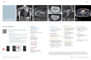 Content 
Content 
Content 
63 
Chondral Fracture 
How I do it 
66 Long Bone Imaging Distal Lower 
Limbs utilizing Tim Technology 
and the Tim User Interface 
James Hancock 
75 Long Bone Imaging Proximal 
Lower Limbs utilizing Tim 
Technology and the Tim User 
Interface 
James Hancock 
84 Frequently Asked Questions: 
Diffusion-Weighted Imaging 
Joachim Graessner 
Product News 
88 Whole-Body MR/PET Hybrid 
Imaging: Technical 
Considerations, Clinical 
Workfl ow, and Initial Results 
Harald H. Quick, et al. 
88 
Biograph mMR 
Clinical mMR 
102 Integrated Whole Body MR/PET 
Imaging. First Examples of Clinical 
Application 
Alexander Drzezga, et al. 
Life 
112 Clinical Perspective of the 
7th MAGNETOM World Summit 
Matthias P. Lichy. 
Cover 
115 Simultaneous MR/PET Examination 
Nina Schwenzer 
32 
7T MRI 
Clinical 
Woman’s Health 
54 STIR versus SPAIR in Breast Imaging: 
a Case-Based Discussion 
Yien Sien Lee, et al. 
Technology 
56 Fat Suppression Techniques – 
a Short Overview 
Wilhelm Horger, Berthold Kiefer 
Clinical MSK 
60 Case Report: Snowboarding Injuries to 
the Middle Subtalar Joint. The Sus-tentacular 
Talocalcaneal Articulation 
Anna K. Chacko, Charles P. Ho 
63 Case Report: Chondral Fracture of 
the Talar Dome and Diastasis of the 
Os Trigonum 
Anna K. Chacko, Charles P. Ho 
24 
MAGNETOM Skyra 
Clinical 
Lung Imaging 
6 MRI of the Lung – ready … 
get set … go! 
Juergen Biederer, et al. 
16 Case Report: Lung Imaging with MRI 
Juergen Biederer 
Clinical 
24 MAGNETOM Skyra: 
The Mannheim Perspective 
Henrik J. Michaely, 
Stefan O. Schoenberg 
Technology 
32 Towards Clinical 7T MRI 
Graham C. Wiggins, 
Daniel K. Sodickson 
Technology 
Neuro 
50 MRI-Based Pattern Recognition 
Methods for Dementia Diagnostics 
Stefan Klöppel 
Further information 
The information presented in MAGNETOM Flash is for illustration only and is not intended to be relied upon by the reader for instruction as to the practice of medicine. 
Any health care practitioner reading this information is reminded that they must use their own learning, training and expertise in dealing with their individual patients. This 
material does not substitute for that duty and is not intended by Siemens Medical Solutions to be used for any purpose in that regard. The treating physician bears the sole 
responsibility for the diagnosis and treatment of patients, including drugs and doses prescribed in connection with such use. The Operating Instructions must always be strictly 
followed when operating the MR System. The source for the technical data is the corresponding data sheets. 
6 
MRI of the lung 
APP 
k The Quick Response (QR) codes in this issue link you with 
external resources and offer further information on the 
subject. Dig in. 
…that’s how it works 
■ You need an iPhone (3GS or higher) or a Smartphone using 
Android. We recommend a mobile with a camera using at 
least 2 Megapixel. 
■ Install a code reader application on your device (there are 
a number of code readers downloadable e.g. at i-nigma). 
■ Start the code reader application on your device, point and 
shoot the camera at the mobile code. 
■ After scanning it with your camera phone, you will have 
instant access to the encoded information straight on the 
display of your mobile device. Enjoy the content. 
www 
4 MAGNETOM Flash 1/2011 · www.siemens.com/magnetom-world MAGNETOM Flash · 1/2011 · www.siemens.com/magnetom-world 5 
 