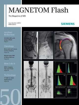 Artifact
Reduction
3D MSK MRI with
syngo SPACE
Page 6
Oncology
Bone and soft tissue
tumor imaging
Page 50
Whole-body DWI
of Bone Marrow
Page 60
How I do it
MSK imaging
Tips and Tricks
Page 58
Technology
7T MRI for MSK
Applications
Page 98
MAGNETOMFlashIssueNumber2/201250
SUBSCRIBE NOW!
– and get your free copy of future
MAGNETOM Flash! Interesting information from
the world of magnetic resonance – gratis to your
desk. Send us this postcard, or subscribe online at
www.siemens.com/MAGNETOM-World
MAGNETOM
Flash
SiemensAG
MedicalSolutions
MagneticResonance
AntjeHellwich-Marketing
P.O.Box3260
D-91050Erlangen
Germany
On account of certain regional limitations of
sales rights and service availability, we cannot
guarantee that all products included in this
brochure are available through the Siemens
sales organization worldwide. Availability and
packaging may vary by country and is subject
to change without prior notice. Some/All of
the features and products described herein may
not be available in the United States.
The information in this document contains
general technical descriptions of specifications
and options as well as standard and optional
features which do not always have to be present
in individual cases.
Siemens reserves the right to modify the design,
packaging, specifications and options described
herein without prior notice.
Please contact your local Siemens sales
representative for the most current information.
Note: Any technical data contained in this
document may vary within defined tolerances.
Original images always lose a certain amount
of detail when reproduced.
www.siemens.com/healthcare-magazine
Global Business Unit
Siemens AG
Medical Solutions
Magnetic Resonance
Henkestr. 127
DE-91052 Erlangen
Germany
Phone: +49 9131 84-0
www.siemens.com/healthcare
Local Contact Information
Asia
Siemens Pte Ltd
The Siemens Center
60 MacPherson Road
Singapore 348615
Phone: +65 6490-8096
Canada
Siemens Canada Limited
Medical Solutions
2185 Derry Road West
Mississauga ON L5N 7A6
Canada
Phone: +1 905 819-5800
Europe/Africa/Middle East
Siemens AG
Medical Solutions
Henkestr. 127
91052 Erlangen
Germany
Phone: +49 9131 84-0
Latin America
Siemens S.A.
Medical Solutions
Avenida de Pte. Julio A. Roca No 516,
Piso 7
C1067ABN Buenos Aires
Argentina
Phone: +54 11 4340-8400
USA
Siemens Medical Solutions U.S.A., Inc.
51 Valley Stream Parkway
Malvern, PA 19355-1406
USA
Phone: +1-888-826-9702
Global Siemens
Healthcare Headquarters
Siemens AG
Healthcare Sector
Henkestrasse 127
91052 Erlangen
Germany
Phone: +49 9131 84-0
www.siemens.com/healthcare
Global Siemens Headquarters
Siemens AG
Wittelsbacherplatz 2
80333 Muenchen
Germany
Order No. A91MR-1000-87C-7600 | Printed in Germany | CC 170 111230. | © 11.12, Siemens AG
k Visit www.siemens.com/
magnetom-world
for case reports,
clinical methods,
application tips,
talks and much more
clinical information. The Magazine of MRI
Issue Number 2/2012
RSNA Edition
MAGNETOM Flash
 