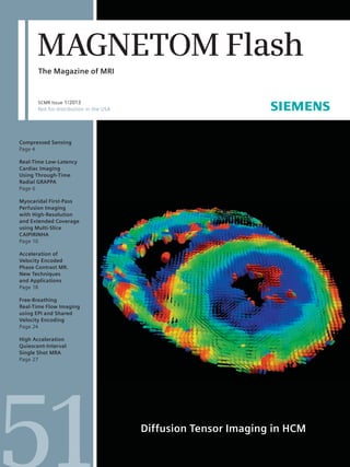 The Magazine of MRI
MAGNETOM Flash
SCMR Issue 1/2013
Not for distribution in the USA
Compressed Sensing
Page 4
Real-Time Low-Latency
Cardiac Imaging
Using Through-Time
Radial GRAPPA
Page 6
Myocaridal First-Pass
Perfusion Imaging
with High-Resolution
and Extended Coverage
using Multi-Slice
CAIPIRINHA
Page 10
Acceleration of
Velocity Encoded
Phase Contrast MR.
New Techniques
and Applications
Page 18
Free-Breathing
Real-Time Flow Imaging
using EPI and Shared
Velocity Encoding
Page 24
High Acceleration
Quiescent-Interval
Single Shot MRA
Page 27
Diffusion Tensor Imaging in HCM
 