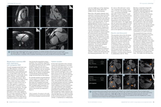 MR Angiography Edition – Issue 53 | PDF