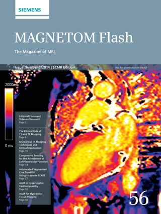 MAGNETOM Flash 
The Magazine of MRI 
Issue Number 1/2014 | SCMR Edition 
56 
Editorial Comment 
Orlando Simonetti 
Page 2 
The Clinical Role of 
T1 and T2 Mapping 
Page 6 
Myocardial T1 Mapping 
Techniques and 
Clinical Application 
Page 10 
Compressed Sensing 
for the Assessment of 
Left Ventricular Function 
Page 18 
Accelerated Segmented 
Cine TrueFISP 
Using k-t-sparse SENSE 
Page 27 
mMR in Hypertrophic 
Cardiomyopathy 
Page 32 
mMR for Myocardial 
Tissue Imaging 
Page 36 
Not for distribution in the US 
 