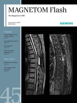MAGNETOM Flash
      The Magazine of MR


      Issue Number 3/2010
      RSNA Edition




Clinical
Tumor staging in case
of Wilms tumor
Page 6

syngo SWI case reports
Page 18

Neurography
Page 26

Spine and tumor
imaging at 3T
Page 48



How I do it
Whole spine imaging
Page 30

Liver imaging with
dynaVIBE
Page 66
 