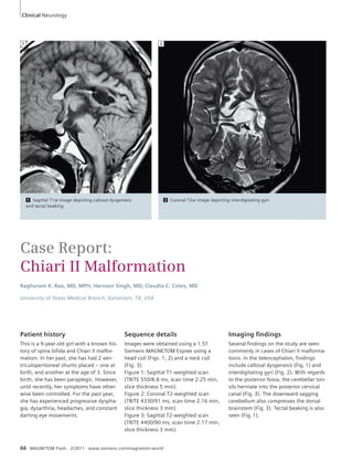 Clinical Neurology 
Case Report: 
Chiari II Malformation 
Raghuram K. Rao, MD, MPH; Harnoor Singh, MD; Claudia C. Cotes, MD 
University of Texas-Medical Branch, Galveston, TX, USA 
Patient history 
This is a 9-year-old girl with a known his-tory 
of spina bifida and Chiari II malfor-mation. 
In her past, she has had 2 ven-triculoperitoneal 
shunts placed – one at 
birth, and another at the age of 3. Since 
birth, she has been paraplegic. However, 
until recently, her symptoms have other-wise 
been controlled. For the past year, 
she has experienced progressive dyspha-gia, 
dysarthria, headaches, and constant 
darting eye movements. 
Sequence details 
Images were obtained using a 1.5T 
Siemens MAGNETOM Espree using a 
head coil (Figs. 1, 2) and a neck coil 
(Fig. 3). 
Figure 1: Sagittal T1-weighted scan 
(TR/TE 550/8.8 ms, scan time 2:25 min, 
slice thickness 5 mm). 
Figure 2: Coronal T2-weighted scan 
(TR/TE 4330/91 ms, scan time 2:16 min, 
slice thickness 3 mm). 
Figure 3: Sagittal T2-weighted scan 
(TR/TE 4400/90 ms, scan time 2:17 min, 
slice thickness 3 mm). 
66 MAGNETOM Flash · 2/2011 · www.siemens.com/magnetom-world 
Imaging fi ndings 
Several findings on the study are seen 
commonly in cases of Chiari II malforma-tions. 
In the telencephalon, findings 
include callosal dysgenesis (Fig. 1) and 
interdigitating gyri (Fig. 2). With regards 
to the posterior fossa, the cerebellar ton-sils 
herniate into the posterior cervical 
canal (Fig. 3). The downward sagging 
cerebellum also compresses the dorsal 
brainstem (Fig. 3). Tectal beaking is also 
seen (Fig. 1). 
2 
1 Sagittal T1w image depicting callosal dysgenesis 
and tectal beaking. 
1 
2 Coronal T2w image depicting interdigitating gyri. 
 