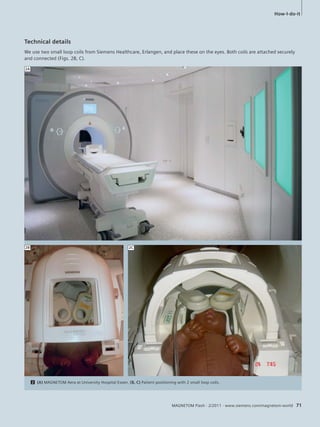 How-I-do-it 
Technical details 
We use two small loop coils from Siemens Healthcare, Erlangen, and place these on the eyes. Both coils are attached securely 
and connected (Figs. 2B, C). 
MAGNETOM Flash · 2/2011 · www.siemens.com/magnetom-world 71 
2C 
2 (A) MAGNETOM Aera at University Hospital Essen. (B, C) Patient positioning with 2 small loop coils. 
2A 
2B 
 