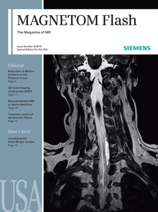 MAGNETOM Flash
      The Magazine of MR


      Issue Number 4/2010
      Special Edition for the USA




Clinical
Reduction of Motion
Artifacts in the
Posterior Fossa
Page 6

3D Knee Imaging
using syngo SPACE
Page 12

Musculoskeletal MRI
in Sports Medicine
Page 20

Traumatic Lesion of
the Brachial Plexus
Page 32



How I do it
Visualizing the
Distal Biceps Tendon
Page 36




USA
 