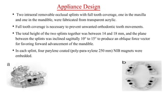 Appliance Design
• Two intraoral removable occlusal splints with full tooth coverage, one in the maxilla
and one in the mandible, were fabricated from transparent acrylic.
• Full tooth coverage is necessary to prevent unwanted orthodontic tooth movements.
• The total height of the two splints together was between 14 and 18 mm, and the plane
between the splints was inclined sagittally 10° to 15° to produce an oblique force vector
for favoring forward advancement of the mandible.
• In each splint, four parylene coated (poly-para-xylene 250 mm) NIB magnets were
embedded.
 