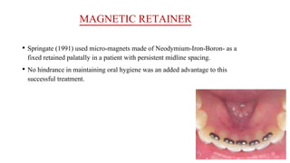 MAGNETIC RETAINER
• Springate (1991) used micro-magnets made of Neodymium-Iron-Boron- as a
fixed retained palatally in a patient with persistent midline spacing.
• No hindrance in maintaining oral hygiene was an added advantage to this
successful treatment.
 