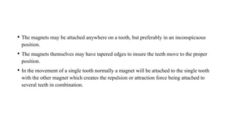 • The magnets may be attached anywhere on a tooth, but preferably in an inconspicuous
position.
• The magnets themselves may have tapered edges to insure the teeth move to the proper
position.
• In the movement of a single tooth normally a magnet will be attached to the single tooth
with the other magnet which creates the repulsion or attraction force being attached to
several teeth in combination.
 