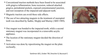 • Conventional traction methods have been found to be associated
with gingiva inflammation, bone recession, reduced attached
gingiva, periodontal pockets, exposed cementoenamel junction,
and root resorption of the impacted and adjacent teeth.
• Magnetic traction can avoid these side effects.
• The use of two attracting magnets in the treatment of unerupted
teeth was described by Sadler, Meghji and Murray ( BJO 1989).
• One magnet was bonded to the impacted tooth, while a second
stationary magnet was incorporated in a removable acrylic
appliance.
• The location of the stationary magnet decided the direction of
force.
• Activation was done by repositioning the magnet on the plate
occlusally.
Vardimon AD1, Graber TM, Drescher D, Bourauel C
 