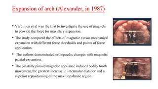 Expansion of arch (Alexander, in 1987)
• Vardimon et al was the first to investigate the use of magnets
to provide the force for maxillary expansion.
• The study compared the effects of magnetic versus mechanical
expansion with different force thresholds and points of force
application.
• The authors demonstrated orthopaedic changes with magnetic
palatal expansion.
• The palatally pinned magnetic appliance induced bodily tooth
movement, the greatest increase in intermolar distance and a
superior repositioning of the maxillopalatine region
 